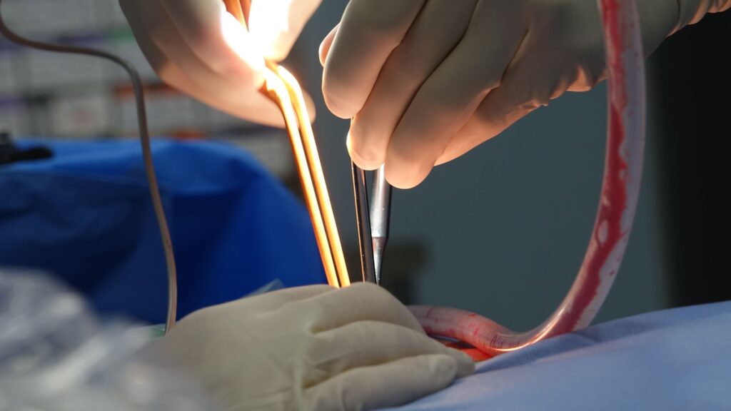 Ombudsman víta plán odškodniť obete nezákonných sterilizácií, čaká na detaily